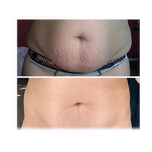 Private Label crema calda dimagrante brucia grassi pancia sudore perdita di peso brucia grassi crema dimagrante - Product Image 4