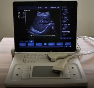 Système d'échographe portable noir et blanc pour ordinateur portable - Product Image 5