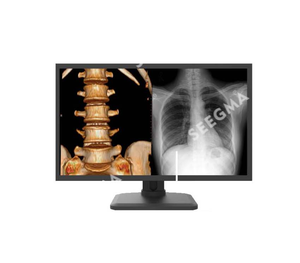 Pantalla de diagnóstico médico gris de color de 4MP de alta calidad - Product Image 1