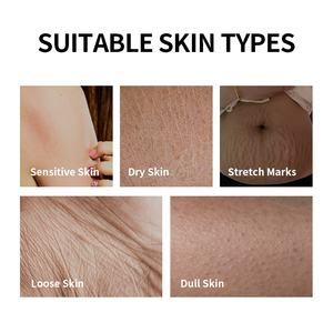 Loción Corporal con Fragancia de Niacinamida OEM/ODM, Anti-Estrías, Reafirmante, Nutritiva y Fortalecedora para Piel Sensible - Product Image 5