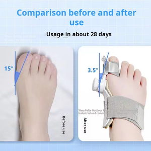 Corrector de Juanetes para Mujeres y Hombres, <span class=keywords><strong>Férula</strong></span> Ortopédica Mejorada para Enderezar el Dedo Gordo del Pie, para Hallux Valgus - Product Image 3
