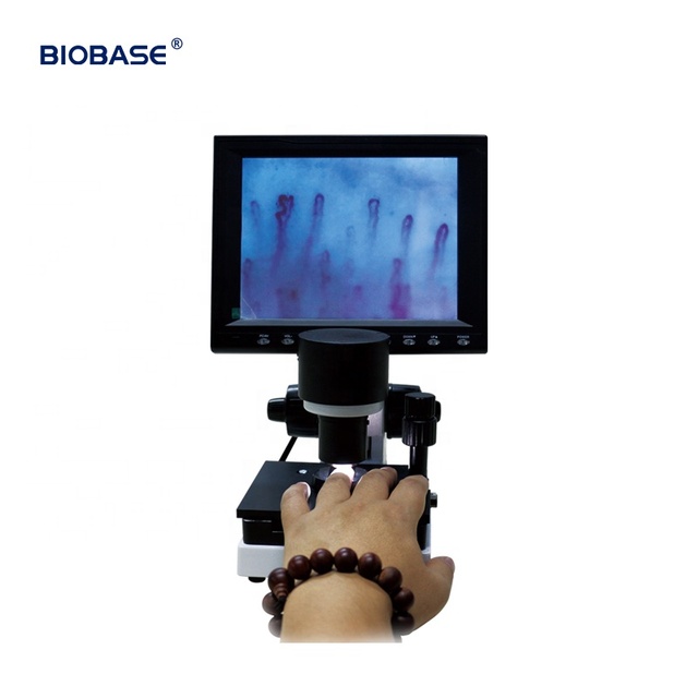 BIOBASE Wholesale Portable LED Display NailFold Video Capillaroscopy Microcirculation Blood Capillary Microscope