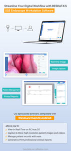 Kit d'otoscope vidéo numérique LED mini BESDATA avec écran LCD de 3 pouces, alimenté par batterie, capture photo et vidéo, certifié CE - Product Image 4