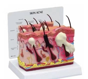 Modello anatomico della pelle umana per la biologia oggetto di metallo modello di occhio per <span class=keywords><strong>le</strong></span> scuole per gli ospedali modello di insegnamento di scienza medica Acne - Product Image 6