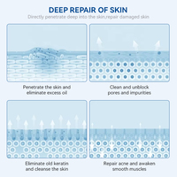 Gel Réparateur Rapide et Efficace Contre les Cicatrices d'Acné et les Taches, Lissant, à l'Acide Salicylique, Réduit les Pores, Crème Visage Anti-Acné