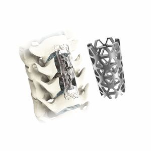 Custom <span class=keywords><strong>Mesh</strong></span> Layar Berlubang <span class=keywords><strong>Titanium</strong></span> Wire <span class=keywords><strong>Mesh</strong></span> untuk Cangkok Tulang - Product Image 5