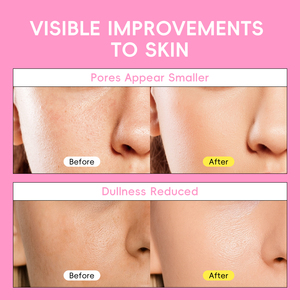 Laikou 50g 5 trong 1 Glow Up siêu Sữa rửa mặt Kem rửa mặt làm trắng Sữa rửa mặt làm sạch sâu lỗ chân lông và giảm thiểu mụn đầu đen - Product Image 6