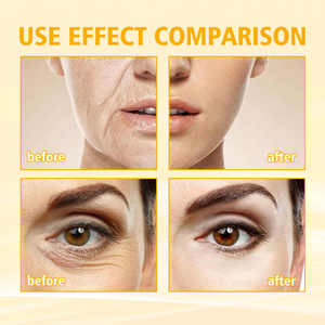 Esencia Facial Hidratante Antiarrugas con Ginseng y Niacinamida, Complejo Radiante, Reduce las Arrugas, Aumenta la Elasticidad, 100 ml - Product Image 2