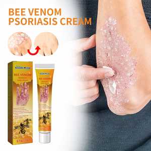 Krim <span class=keywords><strong>Psoriasis</strong></span>, krim kulit infeksi jamur 20G salep Dermatitis Eczema perawatan <span class=keywords><strong>Psoriasis</strong></span> - Product Image 3