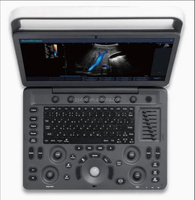 Dispositivo de Ultrasonido Veterinario Portátil Sonoscape E1 EXP V con Monitor HD de 15.6 Pulgadas, Película Protectora Impermeable, Doppler a Color