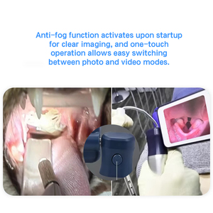 <span class=keywords><strong>Laryngoscope</strong></span> vidéo vétérinaire <span class=keywords><strong>portable</strong></span> CR-31V avec écran tactile de 4,5 pouces pour les services vétérinaires et le tri sur le terrain - Product Image 4