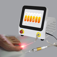 Top vente OEM ou ODM Service 980nm Diode Laser Machine élimination des champignons des ongles traitement de l'onychomycose