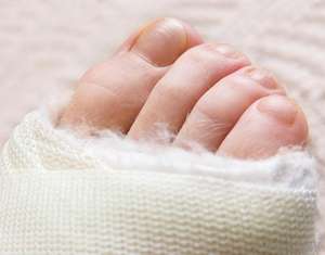 Medische orthopedische gipsverband van glasvezel - Product Image 3