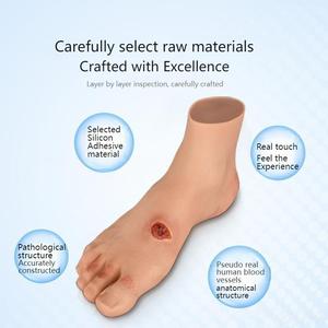 Modelo de pie diabético (leve/grave) para entrenamiento médico y educación - Product Image 5