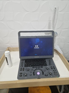 Échographe Doppler Couleur Portable Sonoscape E3V Haute Fiabilité pour Hôpitaux et Cliniques - Product Image 4