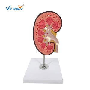 PVC anatomico pietra renale modello di anatomia per la scienza medica di educazione - Product Image 3