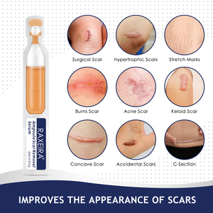 Label privé élimination des cicatrices décoloration réparation des imperfections corporelles hydrater la peau lisse ampoule sérum d'élimination des cicatrices 2ml * 5 bâtons - Product Image 6