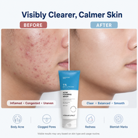 Nettoyant Visage Moussant Traitant l'Acné au Peroxyde de Benzoyle 1% Marque Blanche pour Femmes, Contrôle du Sébum et Nettoyage en Profondeur des Pores