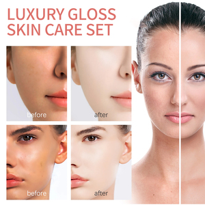 Set de Cuidado Facial con Suero Hidratante y Blanqueador con Vitamina C, AHA y Ácido Hialurónico de Marca Blanca - Product Image 5