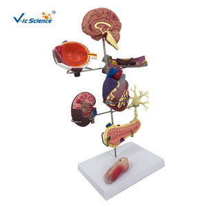 Modelo Anatómico de <span class=keywords><strong>Diabetes</strong></span> Tipo 2, Modelo de PVC para Ciencias Médicas, para Escuelas de Medicina y Hospitales - Product Image 5