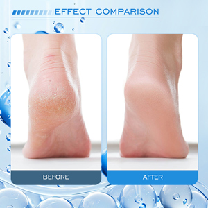 Vente en gros de beurre de cacao de marque privée, crème pour les mains et les pieds avec de la vitamine E, crème hydratante blanchissante et réparatrice pour les pieds - Product Image 6