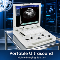 Échographe portable vétérinaire OEM pour diagnostic humain et animaux – Échocardiographe couleur à ultrasons