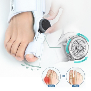 Séparateur orthopédique de traitement des orteils en <span class=keywords><strong>marteau</strong></span>, redresseur, <span class=keywords><strong>correcteur</strong></span> d'oignon, meilleur mélange naturel réglable et Non chirurgical - Product Image 2