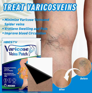 Parches para Várices en Oferta, Alivian <span class=keywords><strong>las</strong></span> Várices <span class=keywords><strong>de</strong></span> <span class=keywords><strong>las</strong></span> Piernas, Eliminan <span class=keywords><strong>las</strong></span> Várices, Parches para la Salud <span class=keywords><strong>de</strong></span> <span class=keywords><strong>las</strong></span> Piernas - Product Image 4