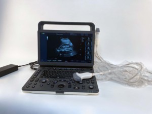 Sistem Diagnosa Ultrasonik Digital 15,6 Inci Satu Atap 3D 4D Color Doppler Mesin Ultrasound Portabel untuk Manusia atau Hewan - Product Image 3