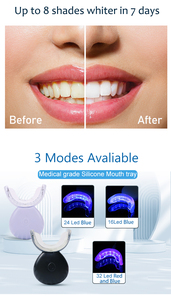 Kit de <span class=keywords><strong>Blanqueamiento</strong></span> <span class=keywords><strong>Dental</strong></span> Inalámbrico de Fábrica OEM/ODM, <span class=keywords><strong>Precio</strong></span> al por Mayor, Solución de Cuidado <span class=keywords><strong>Dental</strong></span> Inteligente Recargable para Mayoristas - Product Image 3