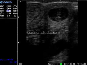 Klinik Hewan Mesin Veteriner OSCAT S1 Pemindai Ultrasound Hewan <span class=keywords><strong>Probe</strong></span> Konveks Linear Rektal untuk Kehamilan Anjing Kucing Kuda - Product Image 6