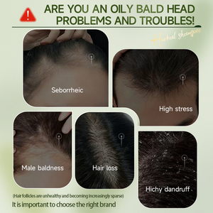 Barra de Champú Herbal de Platycladus Orientalis y <span class=keywords><strong>Henna</strong></span> - Fortalece el Cabello, Calma el Cuero Cabelludo y Cuidado Capilar Natural - Product Image 2