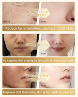 Crème Anti-âge Raffermissante et Liftante pour le Visage à Base de Spicules de Polypeptide EXO, Éliminateur de Rides par Bio-Microneedling, Marque Privée