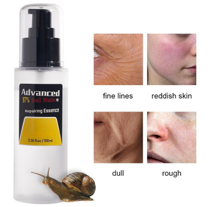 Produits de soins de <span class=keywords><strong>la</strong></span> <span class=keywords><strong>peau</strong></span> sérum facial anti-acné escargot OEM anti-âge élimination des <span class=keywords><strong>taches</strong></span> brunes sérum hydratant réparateur pour le visage - Product Image 1