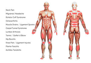 Perangkat terapi <span class=keywords><strong>Laser</strong></span> Level rendah 650nm 808nm <span class=keywords><strong>Bio</strong></span> Class 3B terapi <span class=keywords><strong>Laser</strong></span> dingin untuk perawatan penghilang rasa sakit - Product Image 6