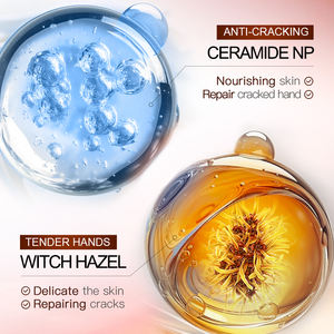 SADOER caffeina <span class=keywords><strong>crema</strong></span> per le <span class=keywords><strong>mani</strong></span> Anti asciugatura Crack <span class=keywords><strong>crema</strong></span> idratante per le <span class=keywords><strong>mani</strong></span> nutriente sbiancante per la cura della pelle delle <span class=keywords><strong>mani</strong></span> - Product Image 4