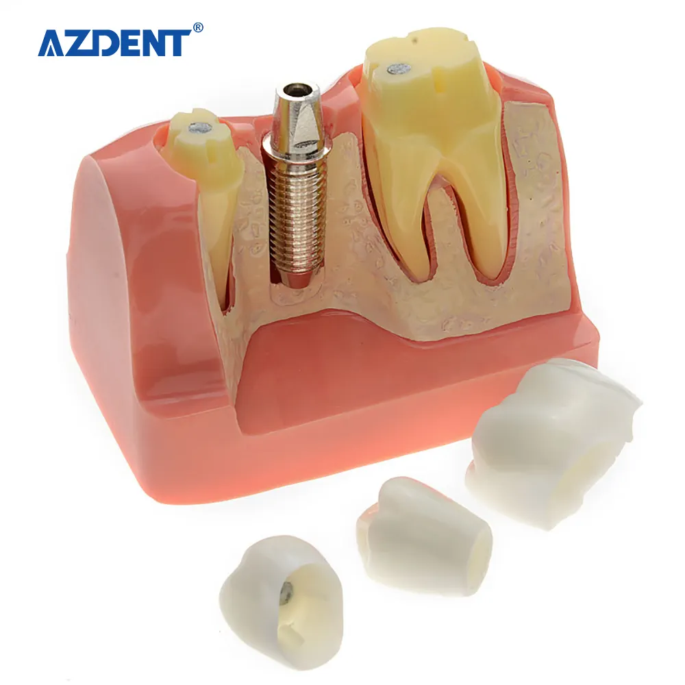 उच्च प्रदर्शन थोक मूल्य डेंटल अध्ययन प्रत्यारोपण हटाने योग्य दांत मॉडल