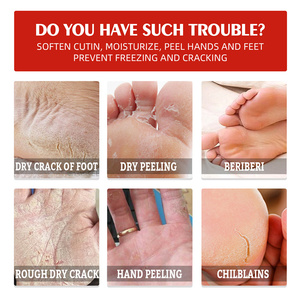 South Moon heel repair cream foot hand exfoliating whitening anti dry beriberi chilblains repair <span class=keywords><strong>crema</strong></span> <span class=keywords><strong>per</strong></span> piedi screpolati logo personalizzato - Product Image 6