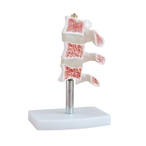 Instrumen pengajaran manekin medis, Simulator anatomi kerangka SC-A1022 3 vertebra Model Oba manusia - Product Image 1