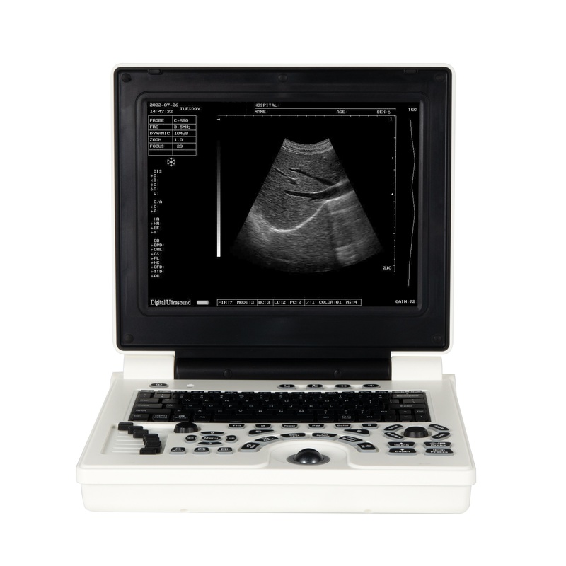 A20 Full Digital Veterinary Ultrasonic Diagnostic