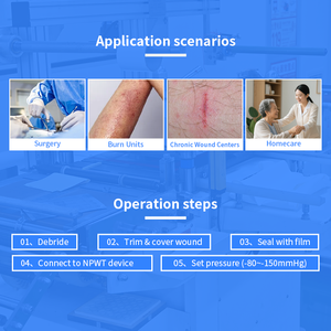 Nuevo Dispositivo de drenaje para el cuidado de heridas en la espalda y el pecho de Grado Profesional, succión de heridas cerrada y apósitos autoadhesivos para heridas - Product Image 3