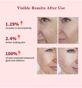 Crème hydratante pour le visage à la gelée de collagène PDRN, collagène <span class=keywords><strong>marin</strong></span> hydrolysé PDRN, crème hydratante raffermissante pour le visage, anti-âge, réparation de la peau - Product Image 5