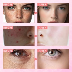 Suero Facial Orgánico Natural con 70% de Niacinamida de Melocotón para Mujeres, Antienvejecimiento, Iluminador, Reduce Manchas Oscuras, Hidratante, Antiedad - Product Image 6