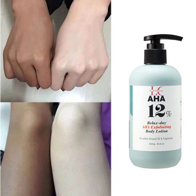 KSL AHA lotion 100ml 3本セット 未使用　最安値 H88a81eb576b341fc92ffa8fe8280f