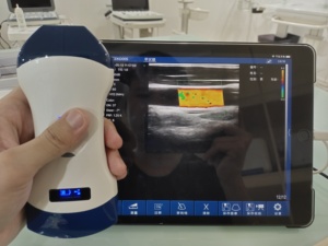 หัวตรวจอัลตราซาวนด์ไร้สาย 2-in-1 รุ่น DMU56 หัวตรวจแบบคอนเว็กซ์และหัวตรวจแบบ Linear ความถี่ 10-12MHz สำหรับการสแกนทางคลินิกอเนกประสงค์ - Product Image 6