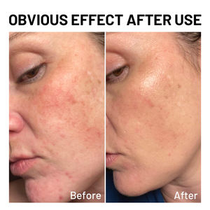 Ensemble de soins de la peau du <span class=keywords><strong>visage</strong></span> au riz hydratant blanchissant nourrissant de marque privée 5 pièces à utiliser pour le <span class=keywords><strong>visage</strong></span> - Product Image 6