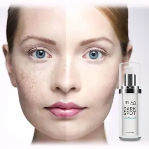 Private Label Natural Collagen Dark Spot Corrector Remover Brightening Anti Aging Face Serum For Sensitive Skin