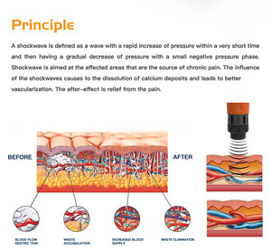 Máquina de Terapia de Ondas de Choque para Uso Equino para Alivio Rápido del Dolor - Product Image 6