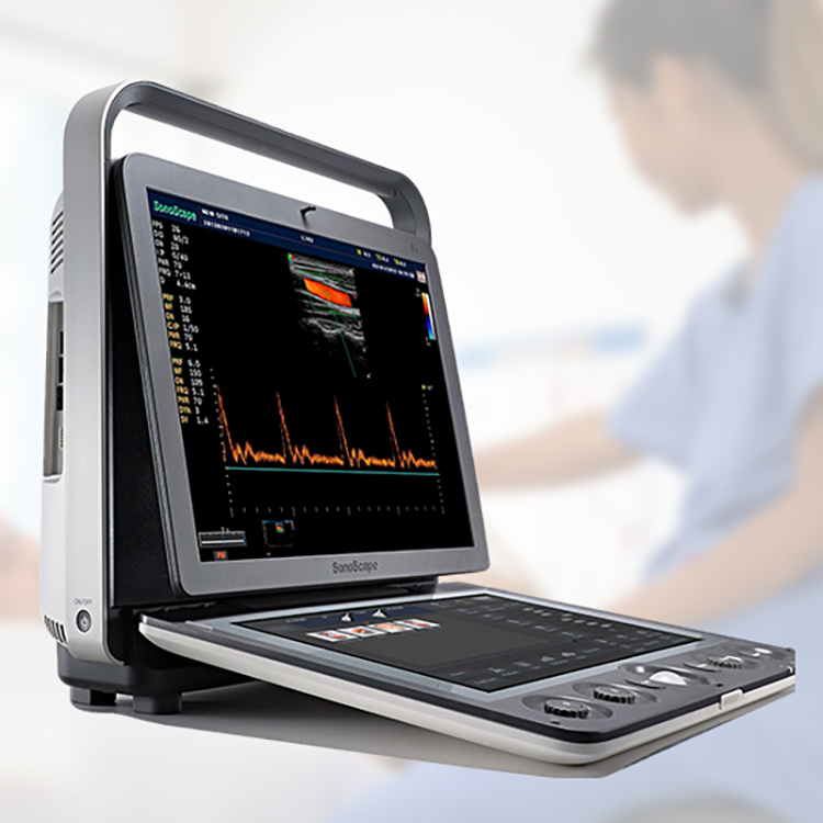 Máquina de ultrasonido de alta resolución Sonoscape S9 Sistema de ultrasonido Doppler en color con sonda
