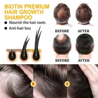 OEM/ODM Biotin-Shampoo gegen Haarausfall, Haarpflegeset mit Maske, 7-Tage-Biotin(B7)-Haarwachstum, Aminosäuren-Trockenshampoo
